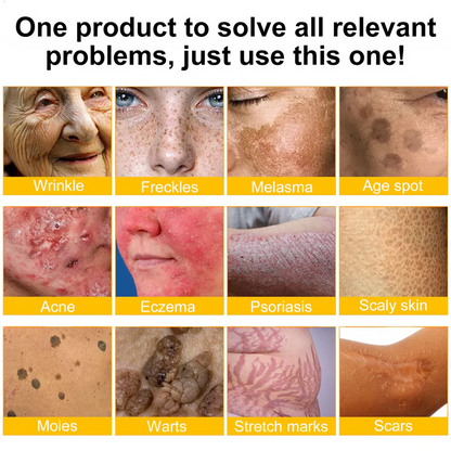 ✨Ourlyard® Bee Venom Skin Restoration Cream — 🔥Limited Time 80% OFF🔥