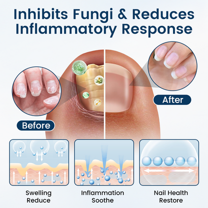 🎀Ourlyard® NailGuard Fungal Repair Herbal Spray