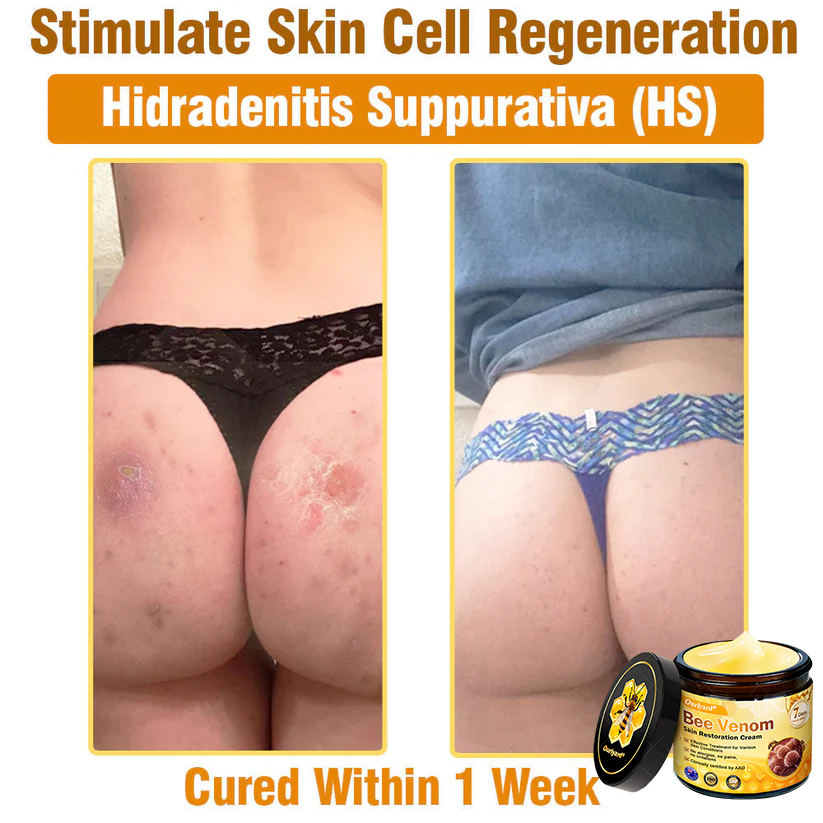 ✨Ourlyard® Bee Venom Skin Restoration Cream — 🔥Limited Time 80% OFF🔥