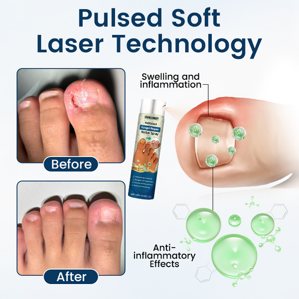 🎀Ourlyard® NailGuard Fungal Repair Herbal Spray