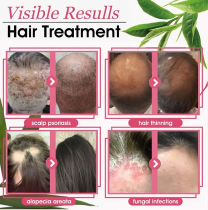 🧡Enjoy 30% OFF for adding the second one🧡