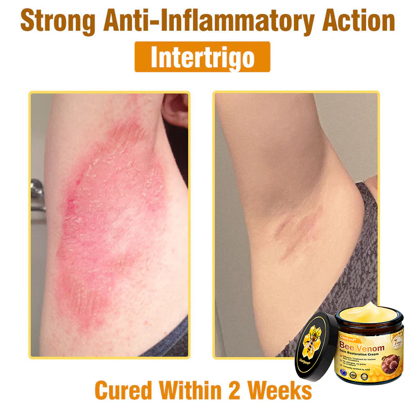 ✨Ourlyard® Bee Venom Skin Restoration Cream — 🔥Limited Time 80% OFF🔥