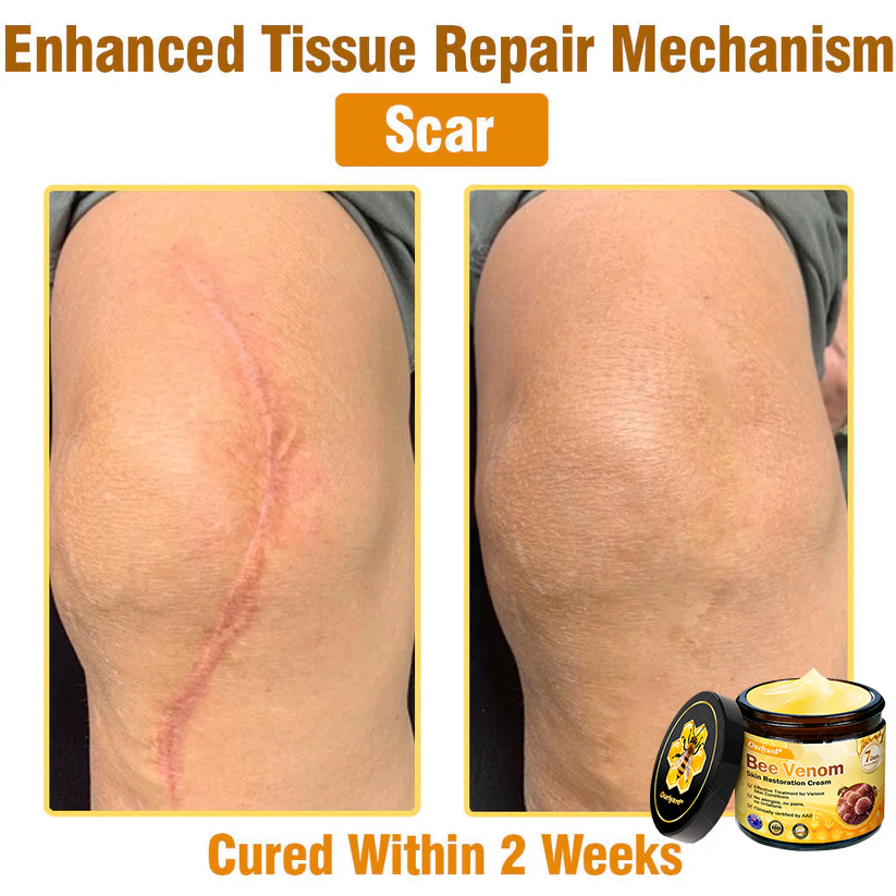 ✨Ourlyard® Bee Venom Skin Restoration Cream — 🔥Limited Time 80% OFF🔥