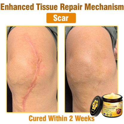 ✨Ourlyard® Bee Venom Skin Restoration Cream — 🔥Limited Time 80% OFF🔥