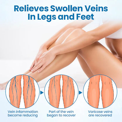 🌱Ourlyard® VeinGuard Herbal Spray – ✅ Clinically proven to eliminate varicose veins in just 7 days!