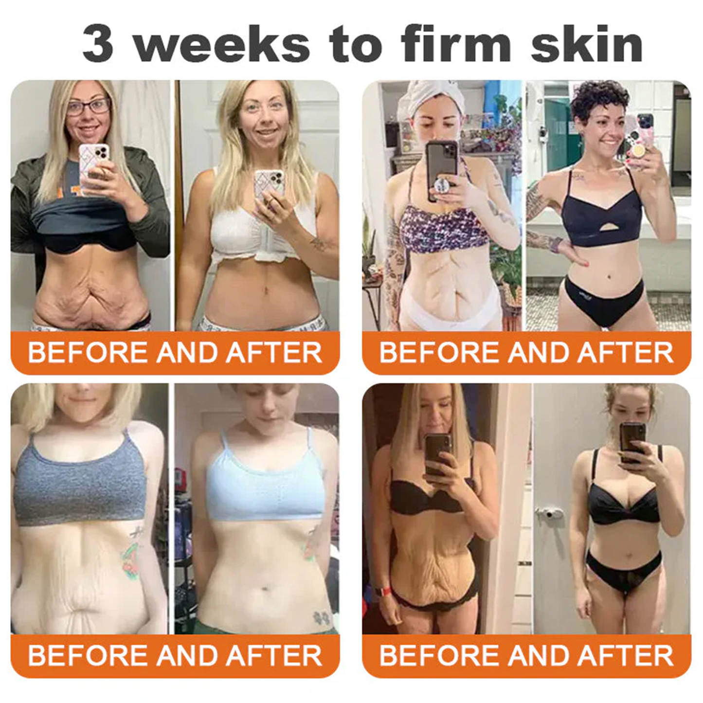 🔥TGA Approved: Ourlyard® Bee Venom Skin Restoration Cream — 🔥Limited Time 80% OFF🔥