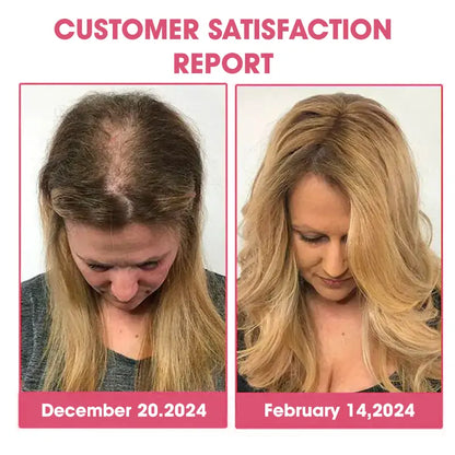 🧡Enjoy 30% OFF for adding the second one🧡